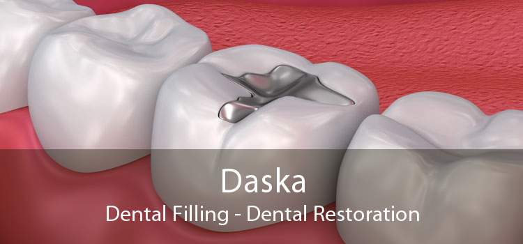 Daska Dental Filling - Dental Restoration