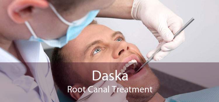 Daska Root Canal Treatment