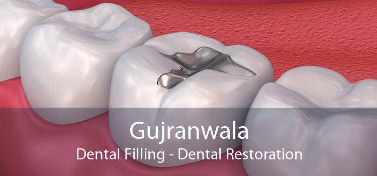 Gujranwala Dental Filling - Dental Restoration