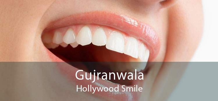 Gujranwala Hollywood Smile