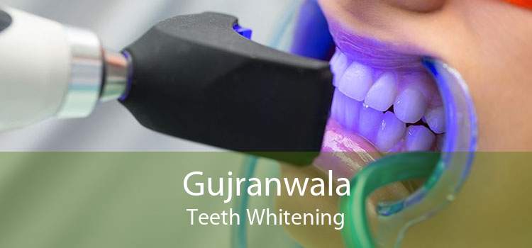 Gujranwala Teeth Whitening