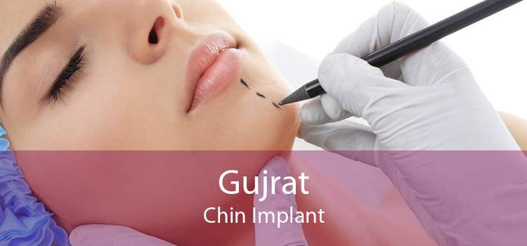 Gujrat Chin Implant