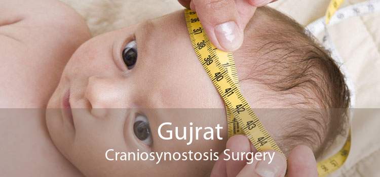 Gujrat Craniosynostosis Surgery