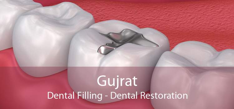 Gujrat Dental Filling - Dental Restoration