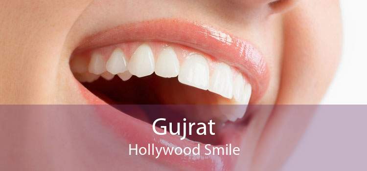 Gujrat Hollywood Smile