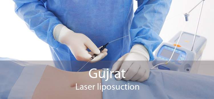 Gujrat Laser liposuction