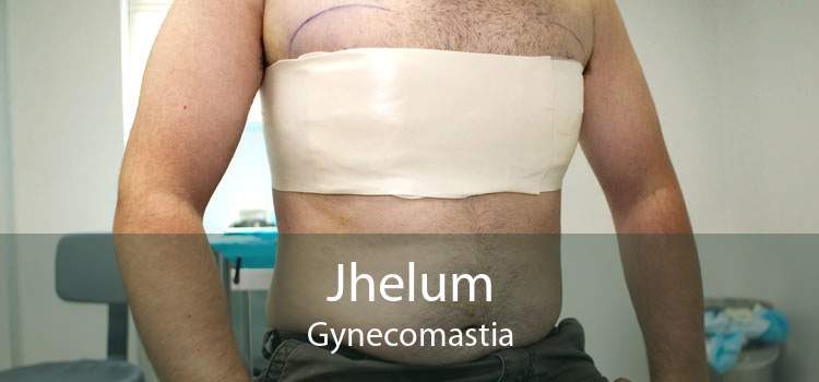 Jhelum Gynecomastia