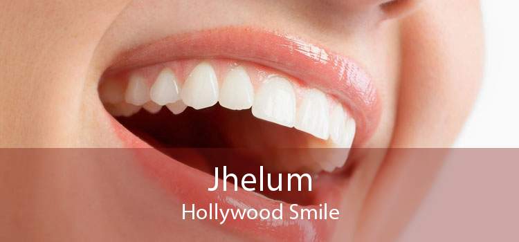 Jhelum Hollywood Smile