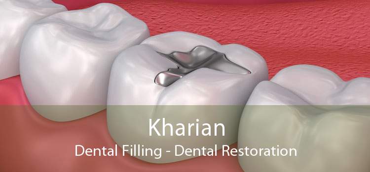 Kharian Dental Filling - Dental Restoration