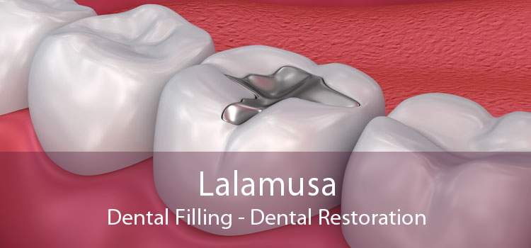 Lalamusa Dental Filling - Dental Restoration