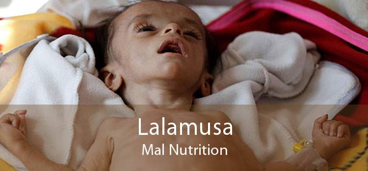 Lalamusa Mal Nutrition