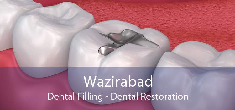 Wazirabad Dental Filling - Dental Restoration