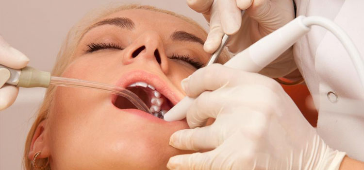 dental-filling-procedure